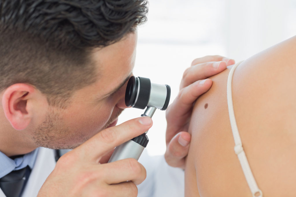 Dermatologist checking mole