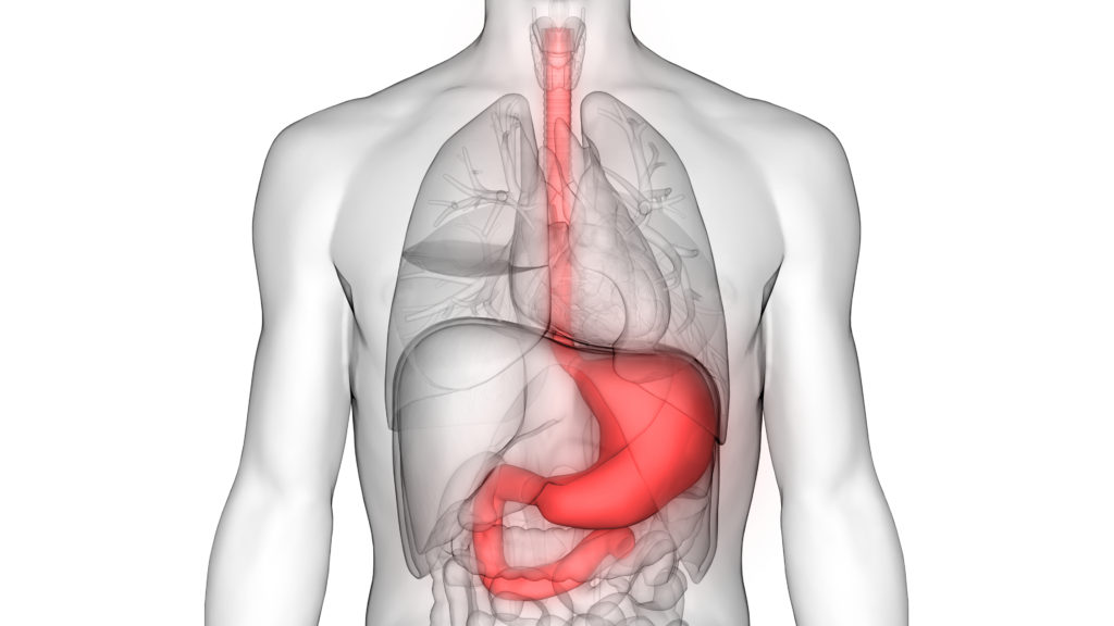 abdominal cancer tumor