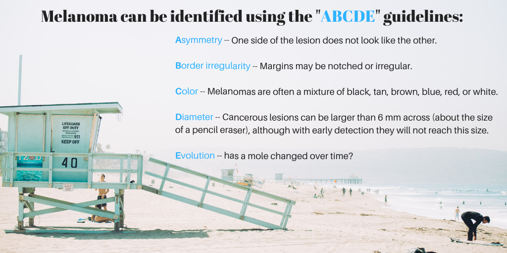 ABCDE Guideline to identify Melanoma