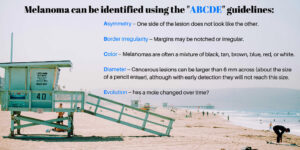 Skin Cancer Awareness - ABCDEs of Melanoma