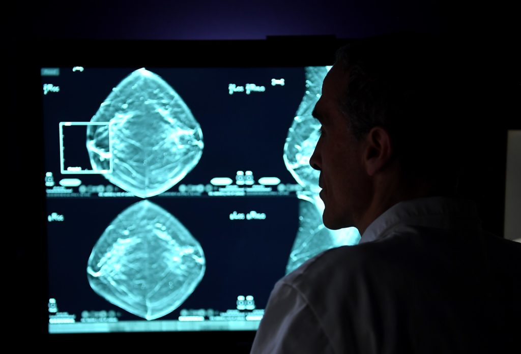 Breast Cancer Signs Symptoms And Understanding An Imaging Report Saint John S Cancer Institute