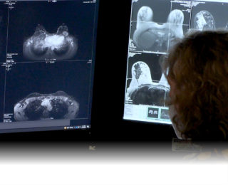 Breast Team Imaging - Margie Petersen Breast Center