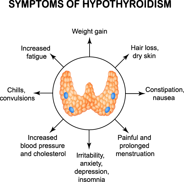 Hypothyroidism Underactive Thyroid Symptoms Diagnosis And Treatment 
