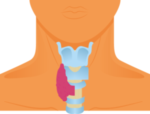 thyroid