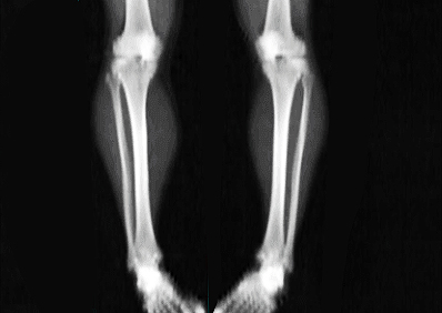 DEXA Bone Scan