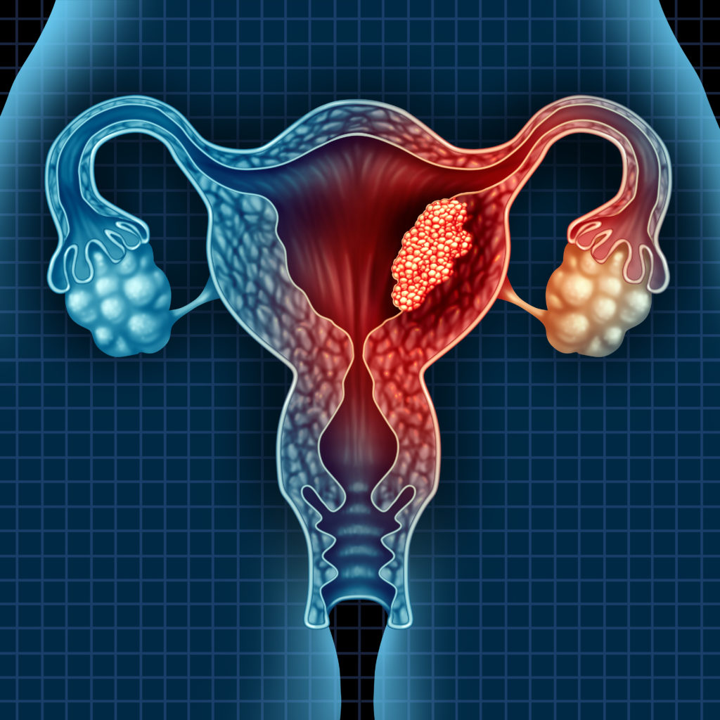 Aggressive cancer of the womb, Tipuri și descrierea viermilor