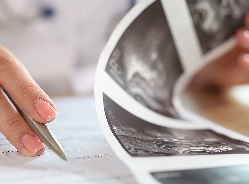 Transvaginal ultrasound