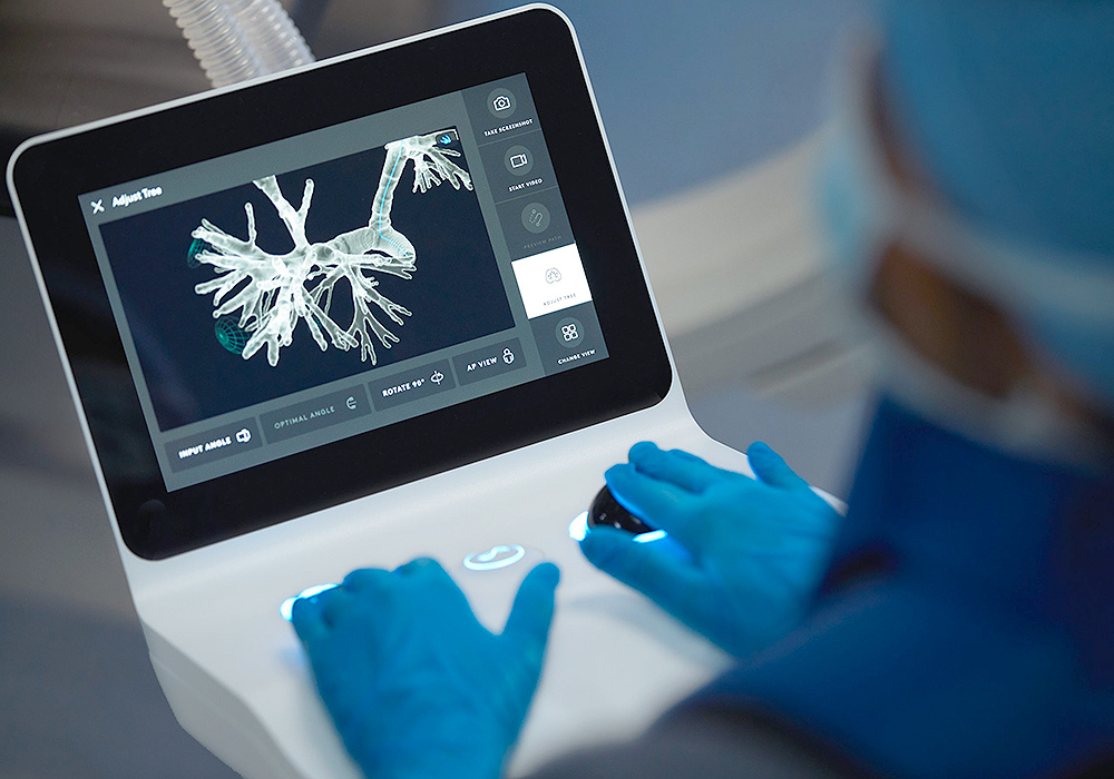 Intuitive Ion Bronchoscopy - Saint John's Health Center