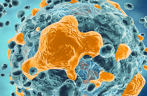 HGT Sample - Saint Johns Cancer Institute