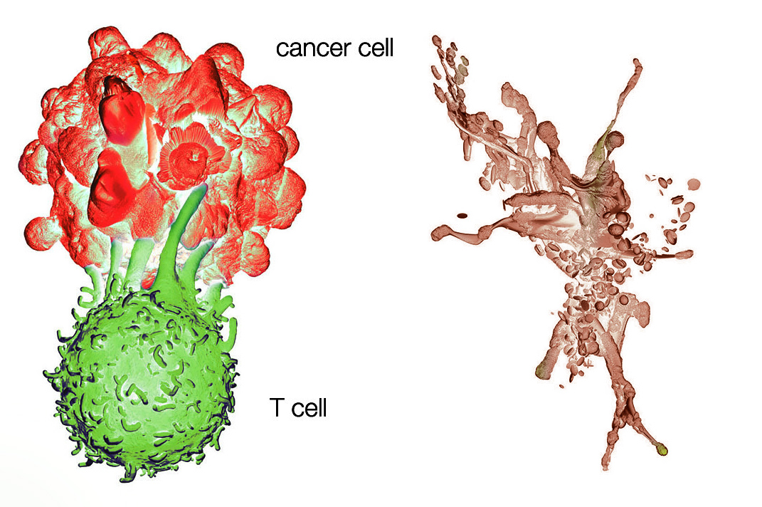 Precision Immunology - Saint John's Cancer Institute