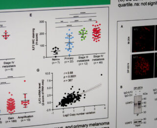 mRNA Findings - Saint John's Cancer Institute