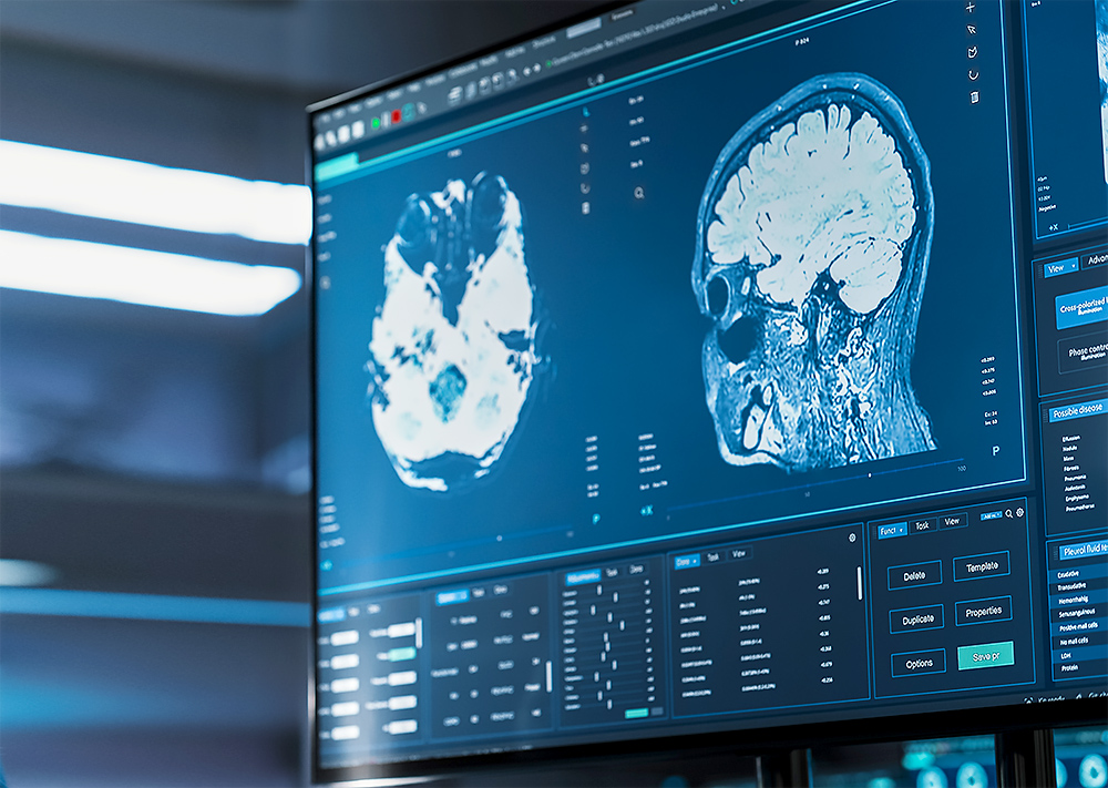 Translational neuroscience