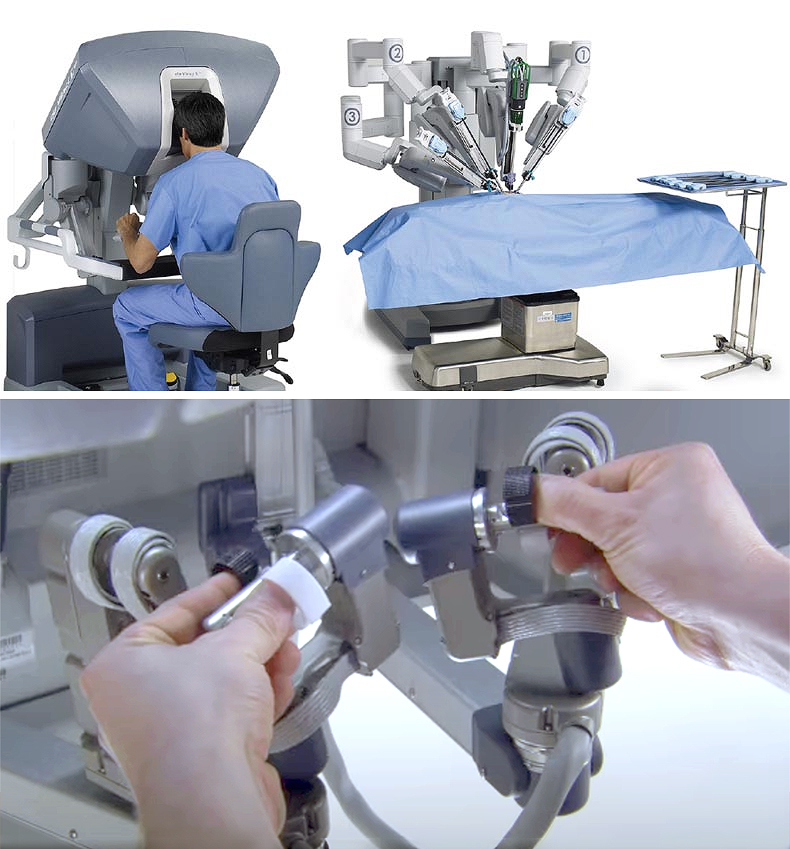 da Vinci Surgical System by Intuitive Surgical - Saint Johns Cancer Institute