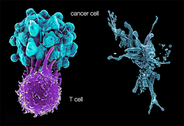 Cancer Cell and T-cell - Immunology and Breast Research
