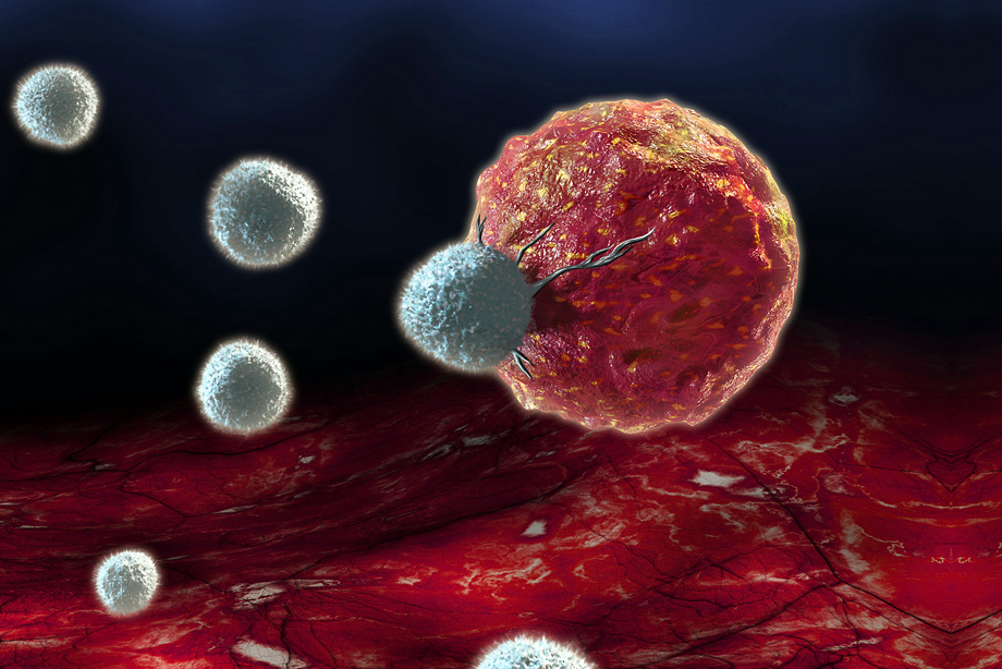 Be-Inspired-Speaker-Series-Cancer-Treatment-Options