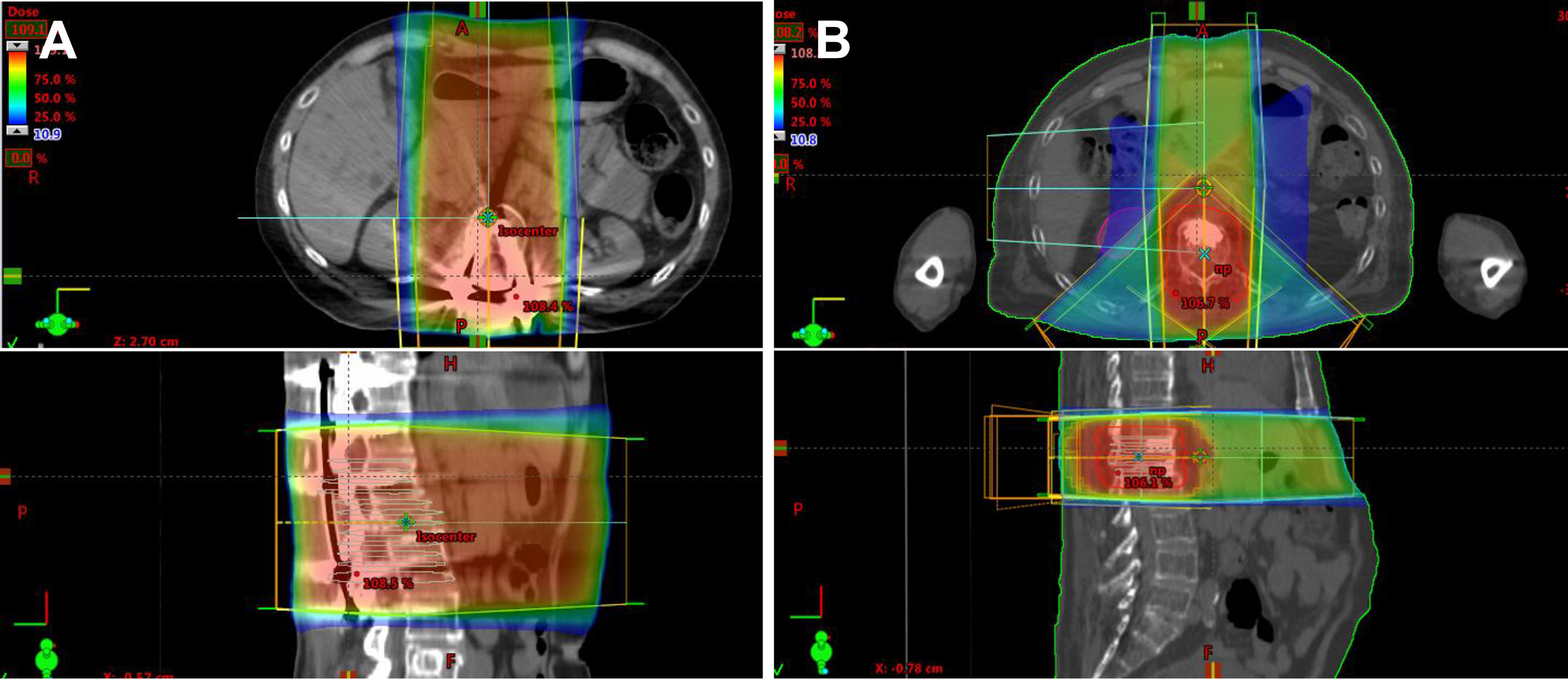 Image Guided Radiation Therapy (IGRT)