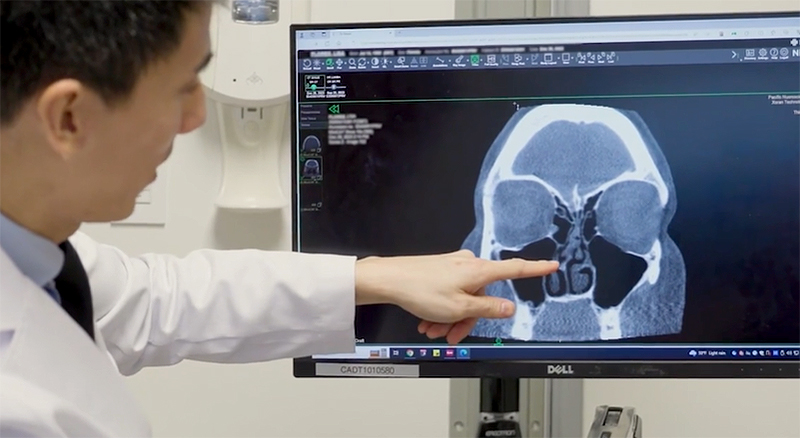 PNI - Looking at scans